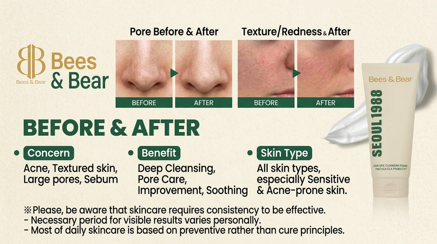 Seoul 1988 Cleansing Foam: A Gentle Daily Cleanser for Balanced Skin