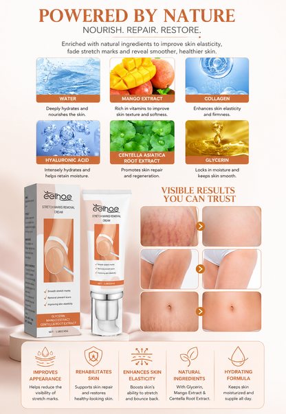 Eelhoe - Stretch Marks Removal Cream