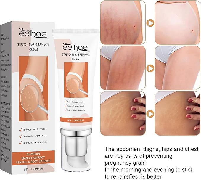 Eelhoe - Stretch Marks Removal Cream