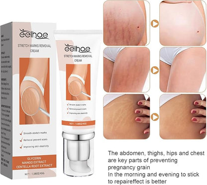 Eelhoe - Stretch Marks Removal Cream
