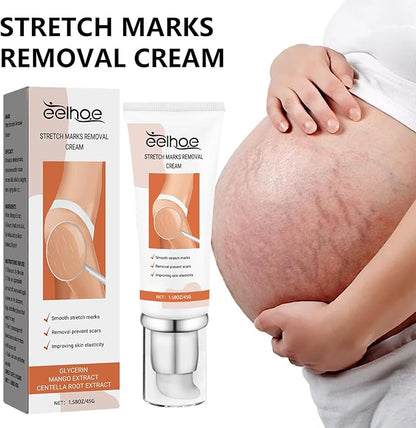 Eelhoe - Stretch Marks Removal Cream