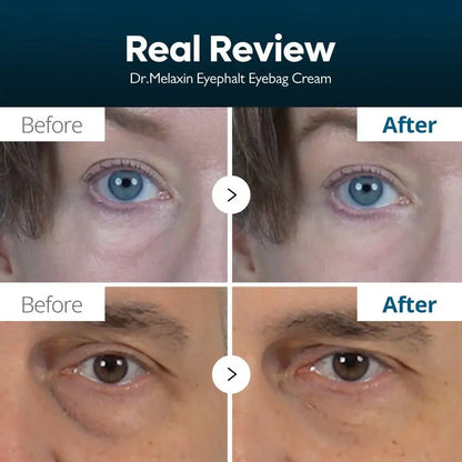 Dr Melaxin Eyephalt Eyecream